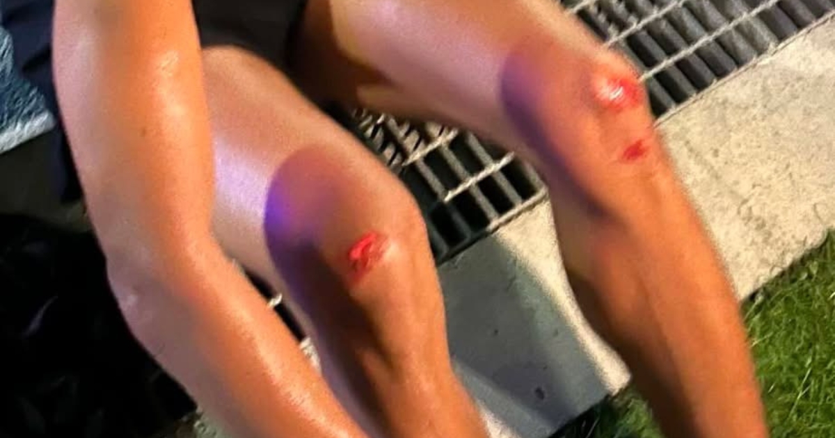 Runner Nahulog sa Kanal sa Minglanilla Oval Human Milikay sa mga Naglakaw sa Lane 1