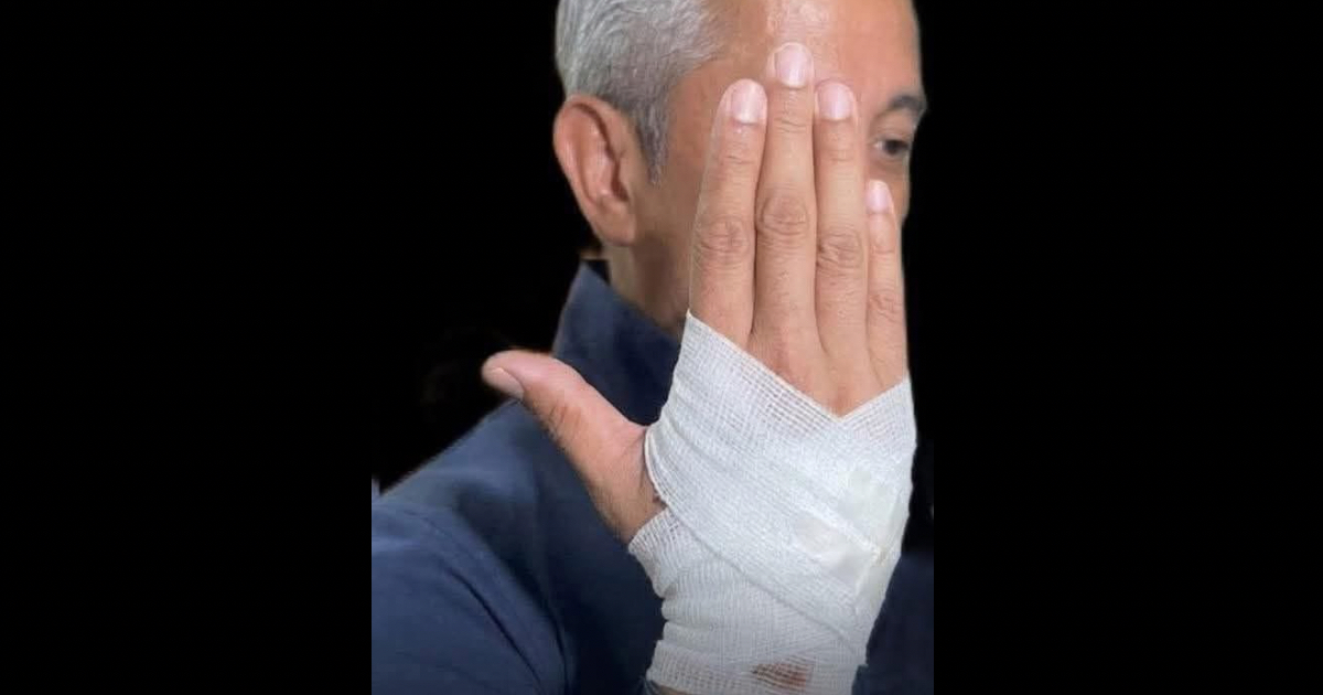 Remulla denies blocking senators, says he was pushed during Senate incident
