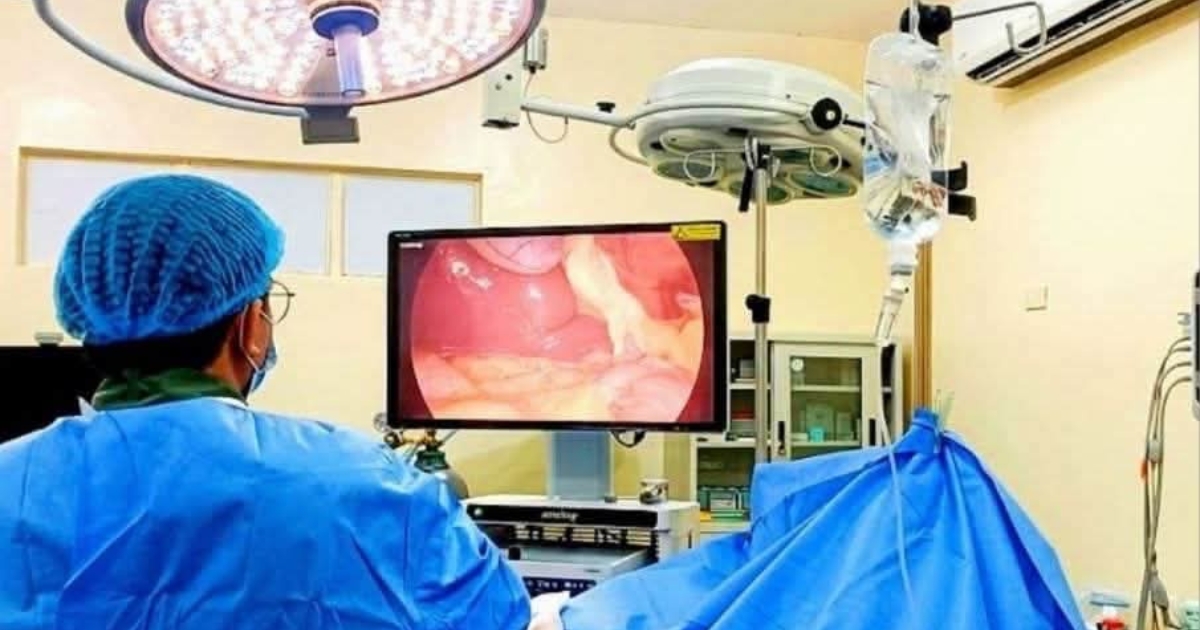Bantayan hospital team performs first laparoscopic gallbladder surgery