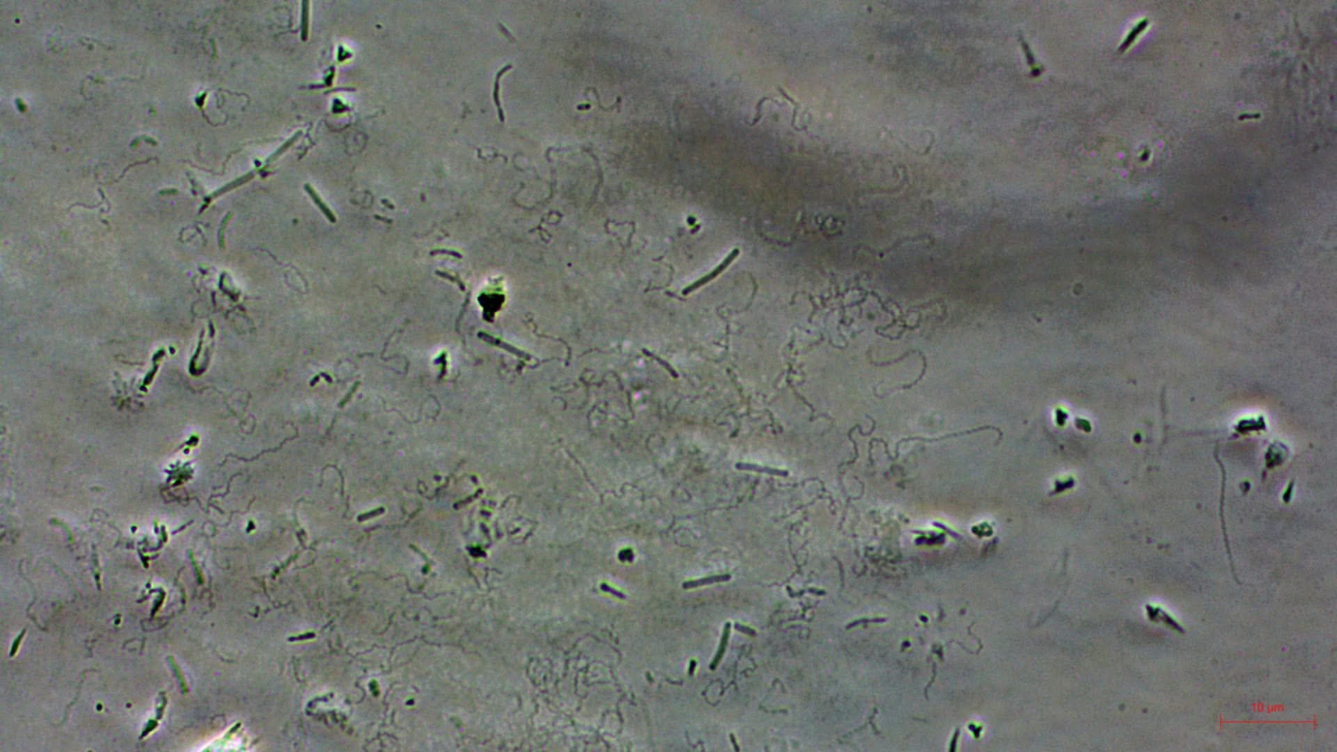 UP scientists detect leptospirosis-causing bacteria across Manila waterway
