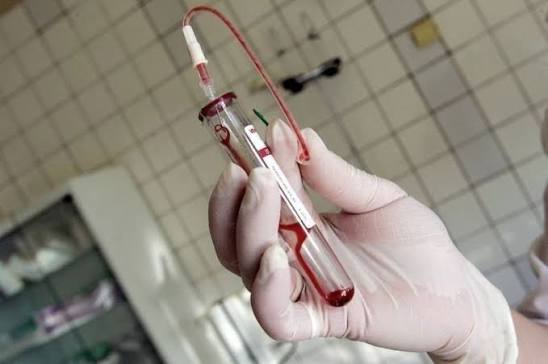 Expert urges stronger HIV prevention programs as Filipino youth face knowledge gaps